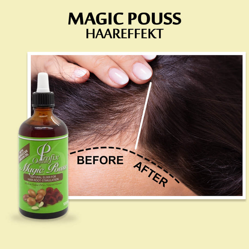 Profix Magic Pouss Natural Elixir for Hair-Root-Stimulation 100ml | gtworld.be 